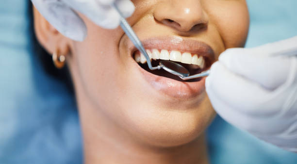 Best Emergency Root Canal Treatment in Branford Center, CT
